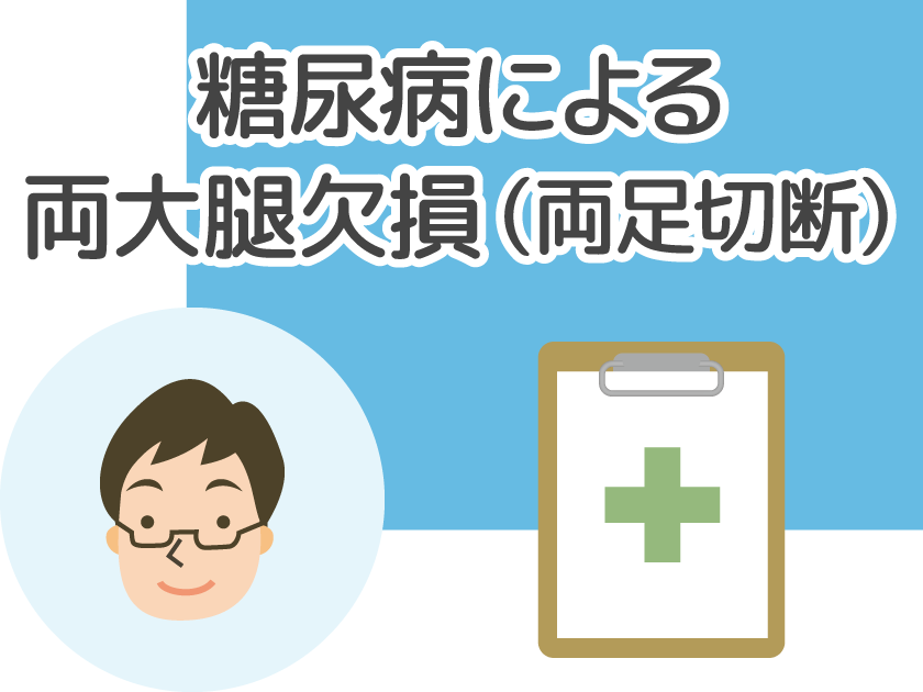 糖尿病による両大腿欠損2分の1以下（両足切断）